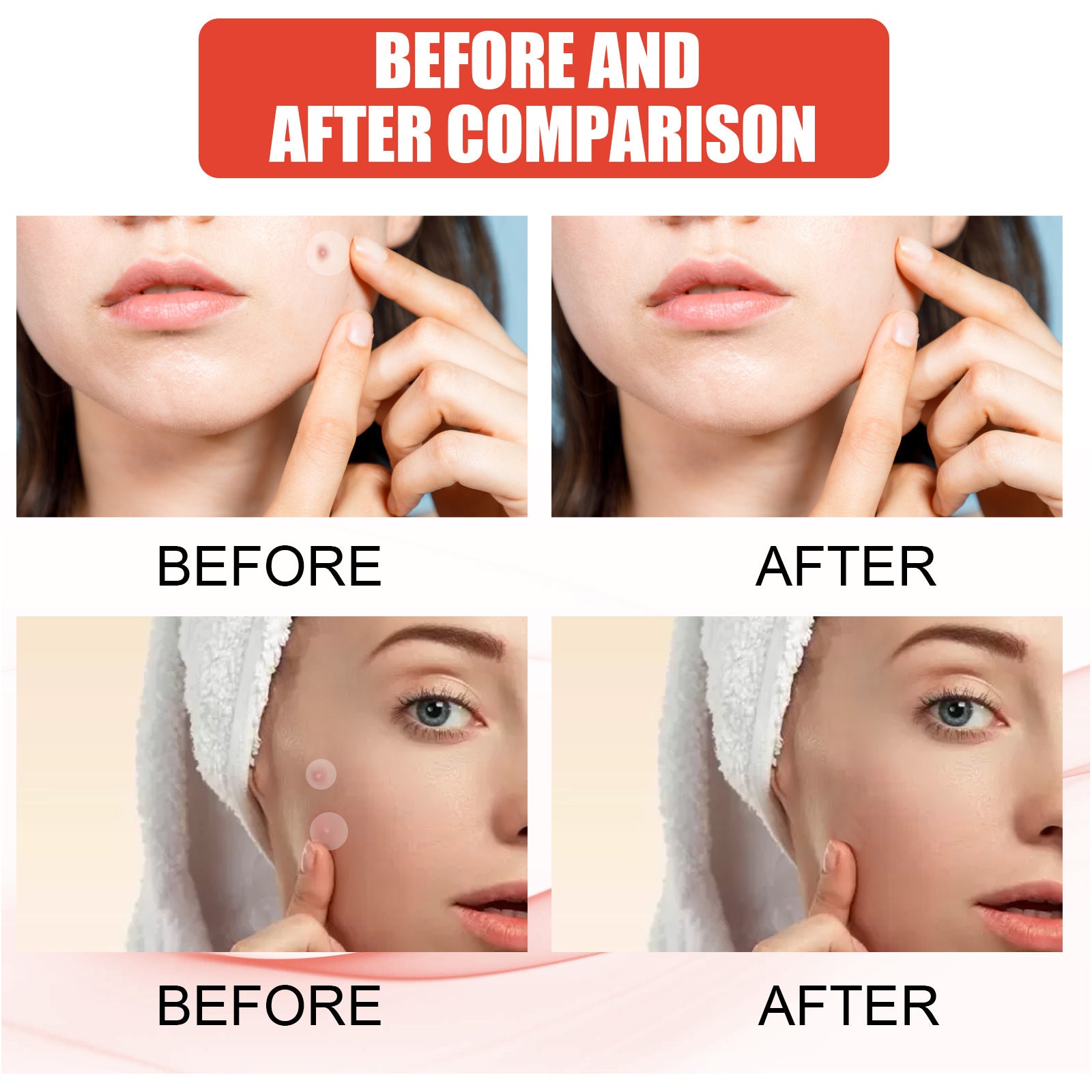 Hydrocolloid Acne Patches Invisible Facial Repair